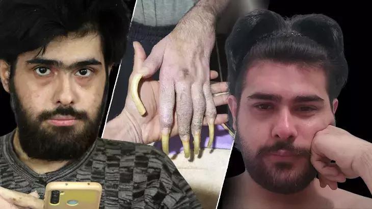 3 yıl sonra evden çıkan Hataylı Barış Özbay’dan ailelere tavsiye: Sakın bunu yapmayın!