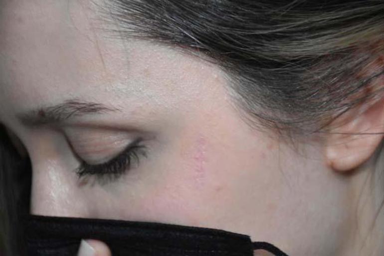 5 ay takip ettiği komşu kızına dehşeti yaşattı: Kabuslar görüyorum