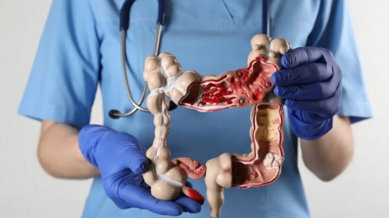 Bu alışkanlıklar kolon kanseri riskini katlıyor!