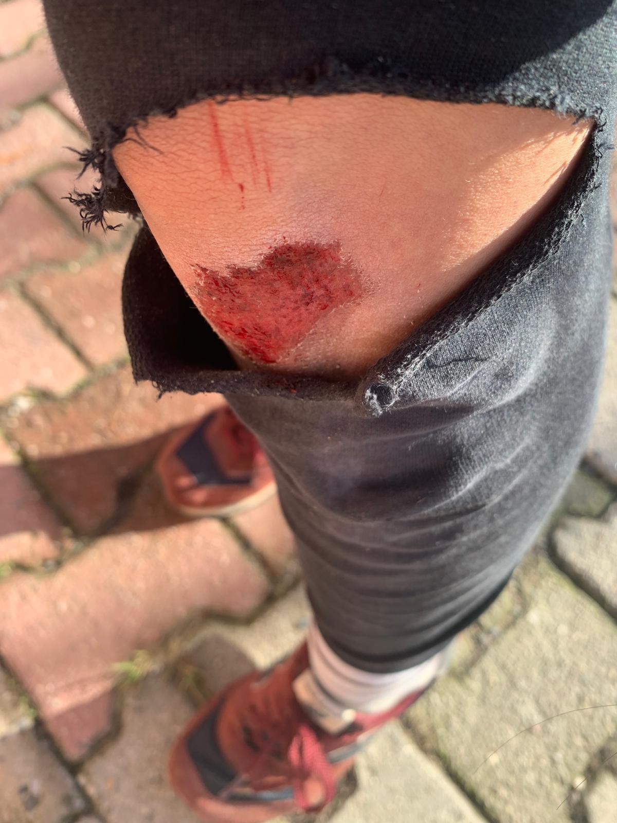 Ezgi Soysal’ın İstismar ve Güvenlik Mücadelesi: Sokaklarda Adalet Arayışı ve Medya Baskısı