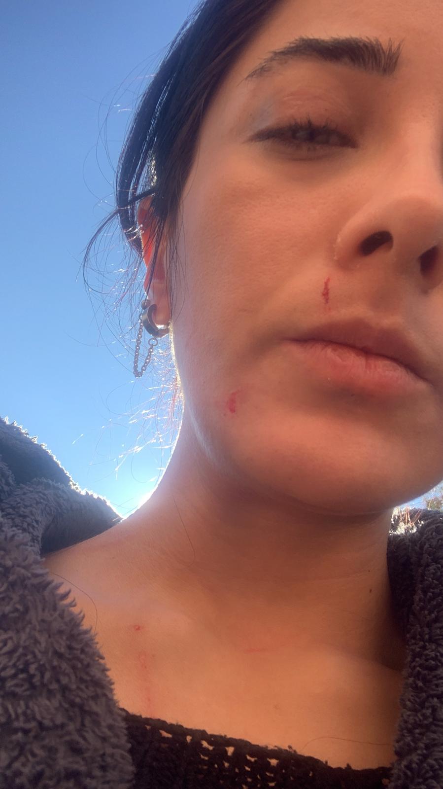 Ezgi Soysal’ın İstismar ve Güvenlik Mücadelesi: Sokaklarda Adalet Arayışı ve Medya Baskısı