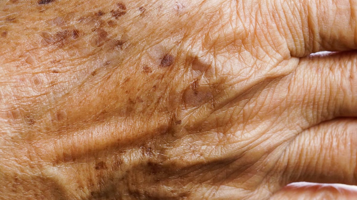 Günde 1 kez sürün, yaşlılık lekelerini götürün…