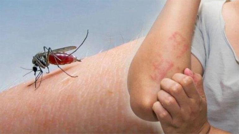 Hiç görülmez deniyordu! 3 sivrisinek ülkede panik yarattı: 'Her yeri sarabilirler' 4 Hiç görülmez deniyordu! 3 sivrisinek ülkede panik yarattı: 'Her yeri sarabilirler'