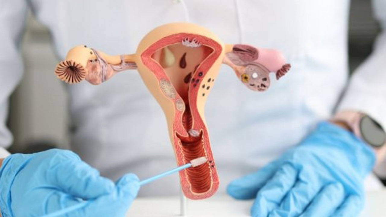 Hormonal dengesizlik sandığınız belirtiler kanser habercisi olabilir