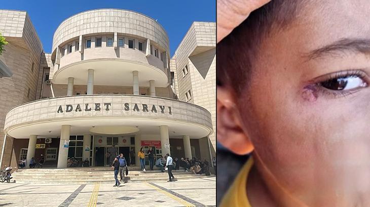 İlkokul Öğrencisine Sigara Söndürdü: Temizlik Görevlisi Gözaltında!