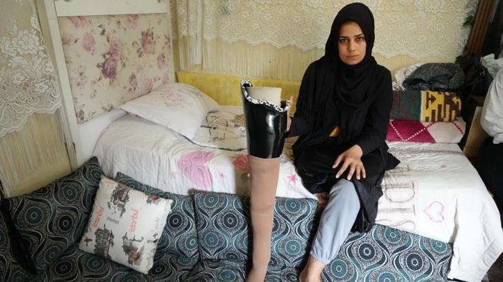 Kahramanmaraş depreminde bacağını kaybetti, eşi terk etti, evladını göremiyor