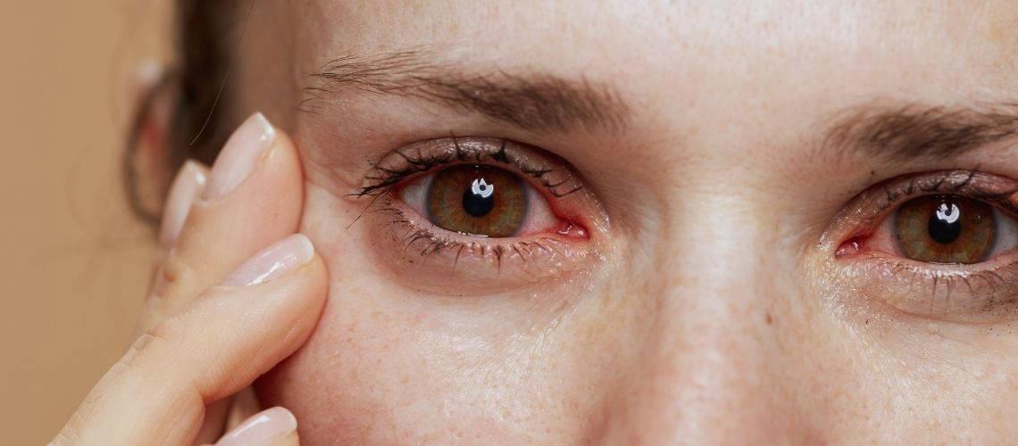 Kışın Göz Enfeksiyonlarına Karşı Dikkat! Yeni Riskler ve Önlemler