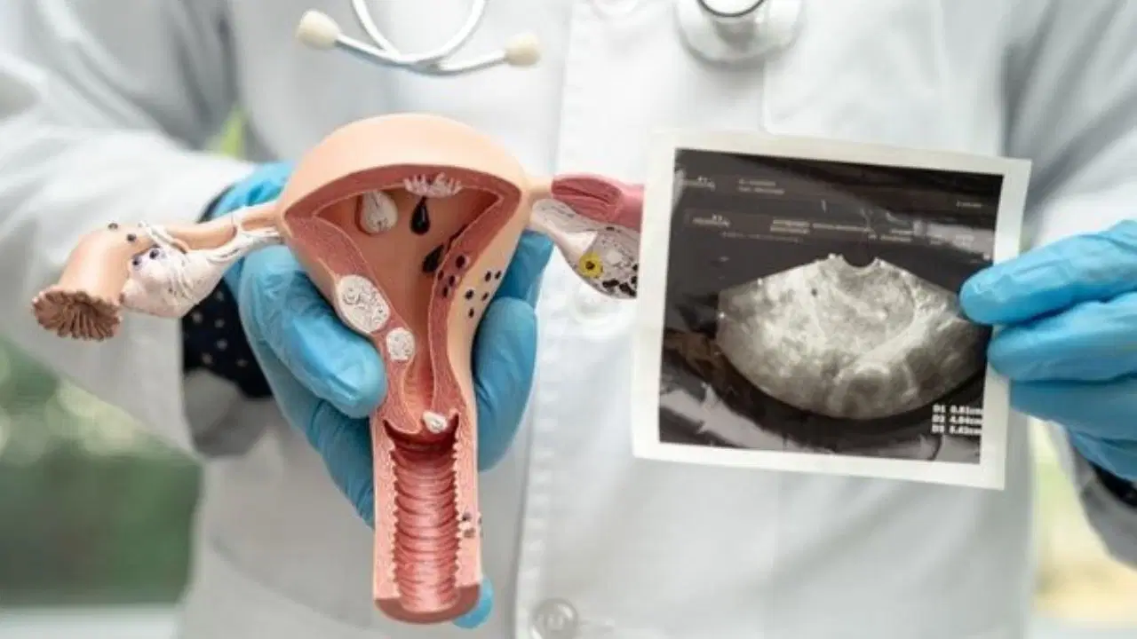 Polikistik over sendromlu kadınlarda zaman algısı araştırıldı