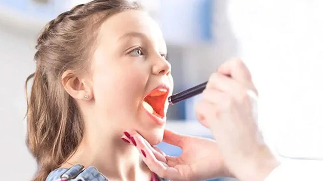 Uzmanı açıkladı: ‘Her bademcik sorunu ameliyat demek değil’