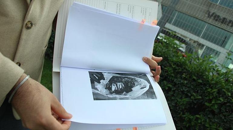 18 milyonluk Porsche alev aldı! Canını zor kurtardı 3 18 milyonluk Porsche alev aldı! Canını zor kurtardı