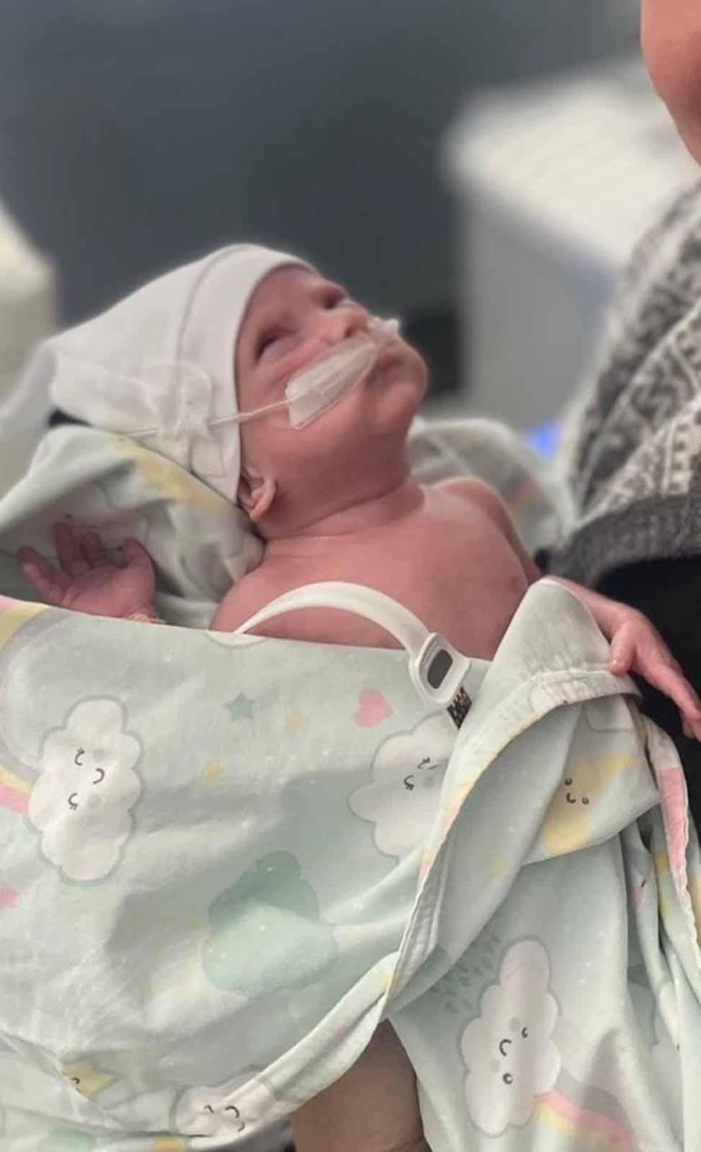 600 gram doğan Asil bebek hayata tutundu 1 600 gram doğan Asil bebek hayata tutundu