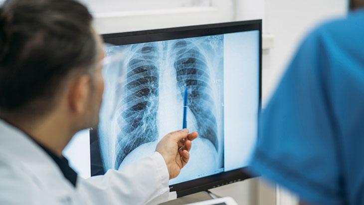 Akciğer röntgeni ciğerlerin yüzde 70’ini gösteriyor! Yüzde 30’u da görmek mümkün