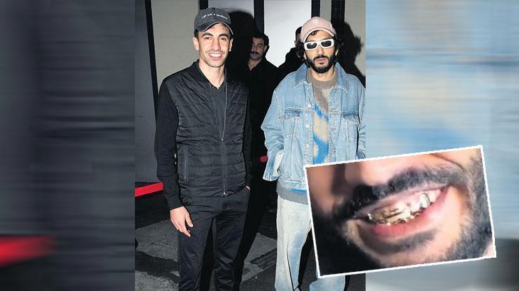 Altın dişleri göz aldı