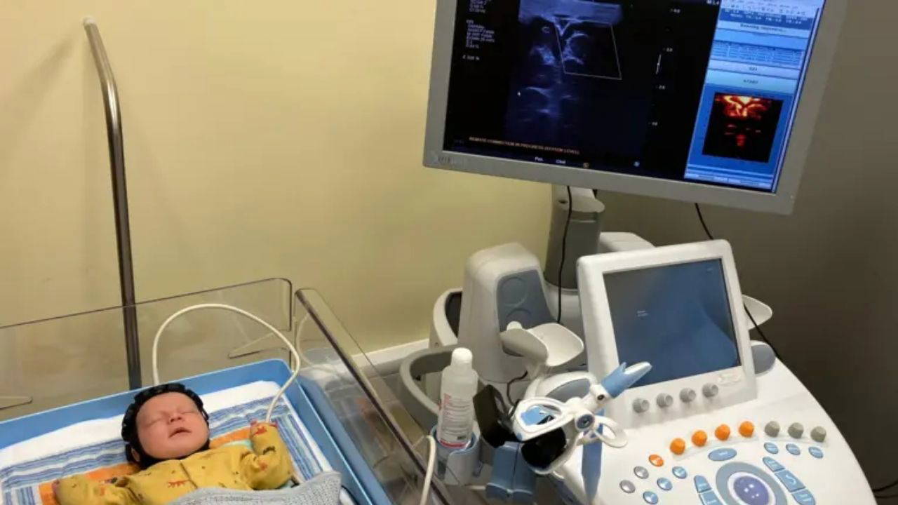 Bilim insanları doğumda beyin hasarını tespit edebilecek başlık geliştirdi 1 Bilim insanları doğumda beyin hasarını tespit edebilecek başlık geliştirdi