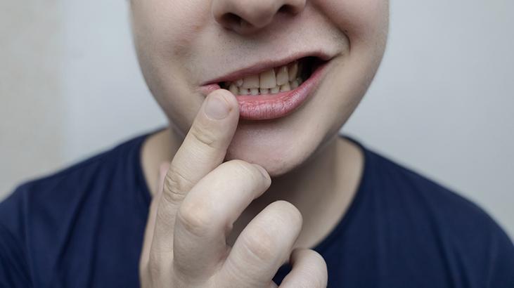 Bir yudum çayla gelen kabus! Doğumdan sonra hayatı değişti: 'Dilim uyuştu' 6 Bir yudum çayla gelen kabus! Doğumdan sonra hayatı değişti: 'Dilim uyuştu'