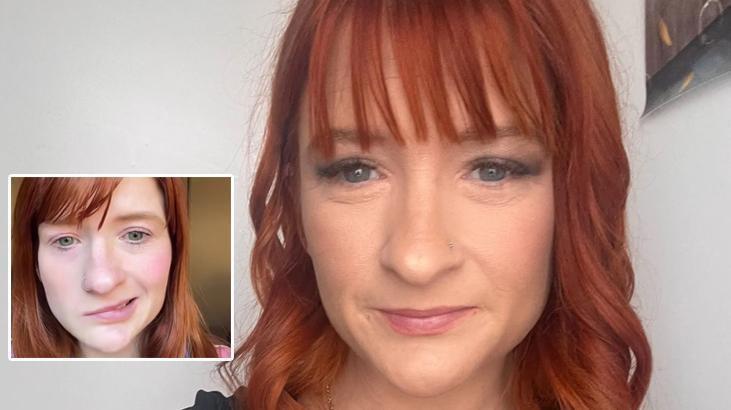 Bir yudum çayla gelen kabus! Doğumdan sonra hayatı değişti: ‘Dilim uyuştu’