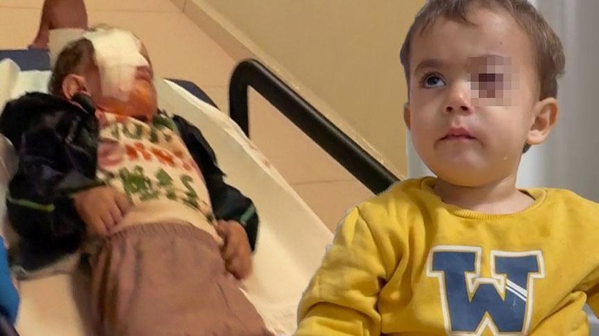 Bursa’da torpil felaketi! 2 yaşındaki çocuğu kör etti: ‘1 hafta önce satmasın diye yalvarmıştım’