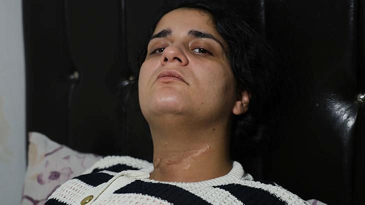 Cips paketini açarken boğazını kesti! Ayrıldığı eşi dehşeti yaşattı: Ölmedin mi sen?