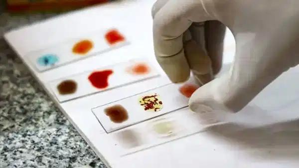 Dünyada yalnızca 50 şahısta var! Kozmik donör olabilecek ‘altın kan’ tipi nedir?