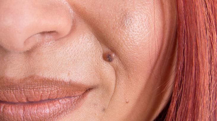 Evde et benlerinden kurtulmak mümkün! Mutfaktaki tek malzeme yetiyor 4 Evde et benlerinden kurtulmak mümkün! Mutfaktaki tek malzeme yetiyor