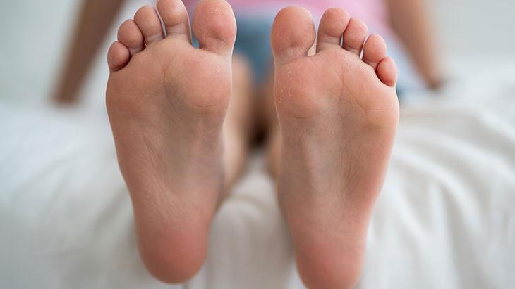 Her 10 çocuktan 7’sinde görülüyor! Bu belirtiler varsa sebebi ‘düztabanlık’ olabilir 5 Her 10 çocuktan 7’sinde görülüyor! Bu belirtiler varsa sebebi ‘düztabanlık’ olabilir