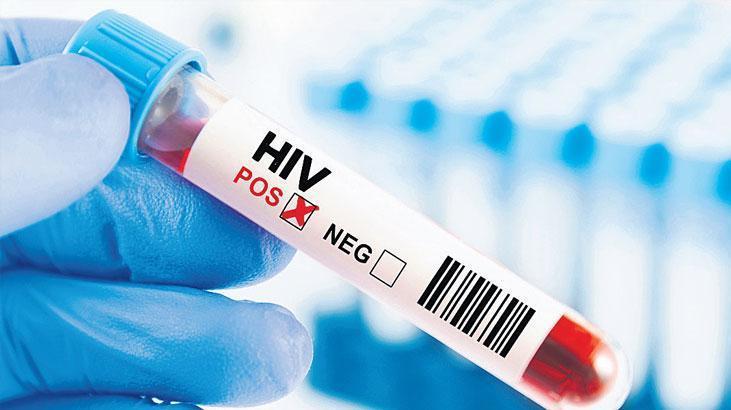 HIV alarmı!