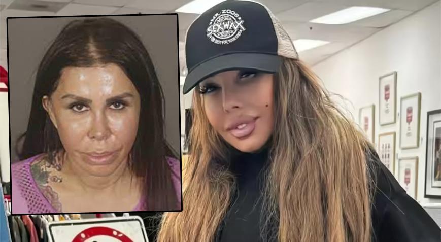 Hollywood’da estetik skandalı: Güzellik aşkı ölüm getirdi