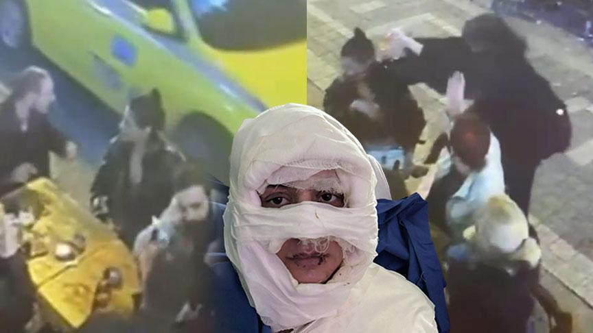 Kadıköy’de vahşet! Çakmakla yakılan kadına kan donduran mesajlar: ‘Kız arkadaşım sizin yüzünüzden hapse girdi…’