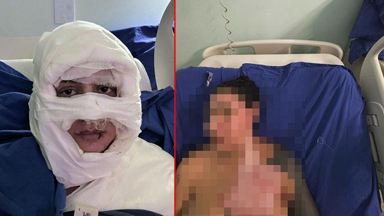 Kadıköy’de vahşet! Çakmakla yakılan kadına kan donduran mesajlar: 'Kız arkadaşım sizin yüzünüzden hapse girdi...' 2 Kadıköy’de vahşet! Çakmakla yakılan kadına kan donduran mesajlar: 'Kız arkadaşım sizin yüzünüzden hapse girdi...'