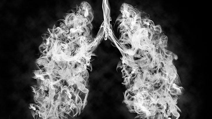 Kadınlarda akciğer kanseri artıyor! Genellikle tesadüfen teşhis ediliyor