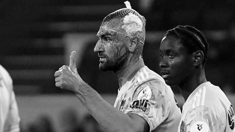 Kafası kanlar içinde kalan Serdar Dursun'un görüntüsü gündem oldu! 'Yaralar geçer, karakter kalır' 3 Kafası kanlar içinde kalan Serdar Dursun'un görüntüsü gündem oldu! 'Yaralar geçer, karakter kalır'