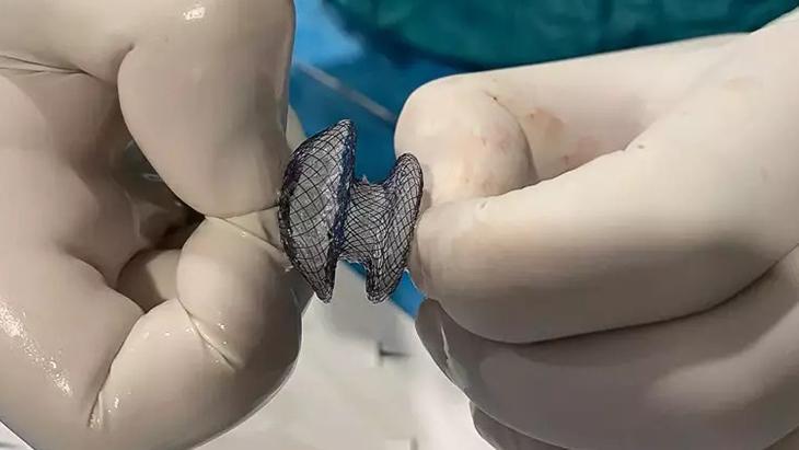 Kalpteki delik artık korkutmuyor: Modern kapalı yöntemle 15 dakikada tedavi