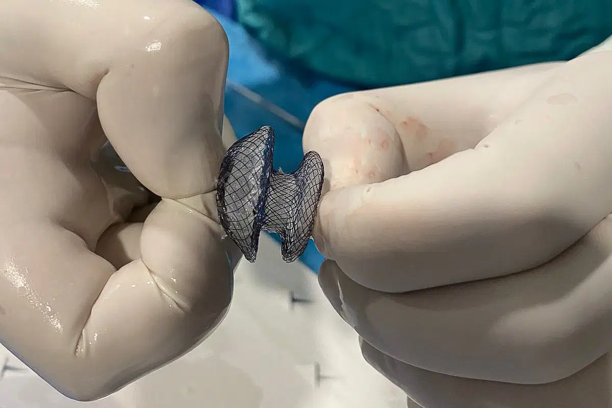 Kalpteki ‘gizli delik’ erken fark edilmezse hayatı tehdit ediyor 2 Kalpteki ‘gizli delik’ erken fark edilmezse hayatı tehdit ediyor