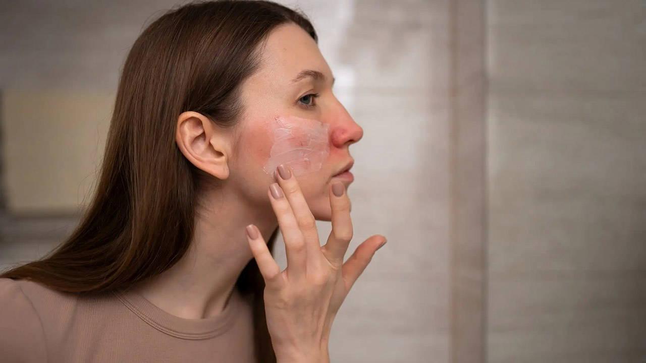 Kış aylarında görülen deri hastalıklarına dikkat!