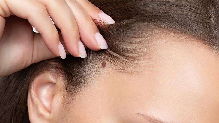 Lazer de yaptıran da var, solüsyon süren de! 'Her ben masum değil, incelenmeli' 2 Lazer de yaptıran da var, solüsyon süren de! 'Her ben masum değil, incelenmeli'