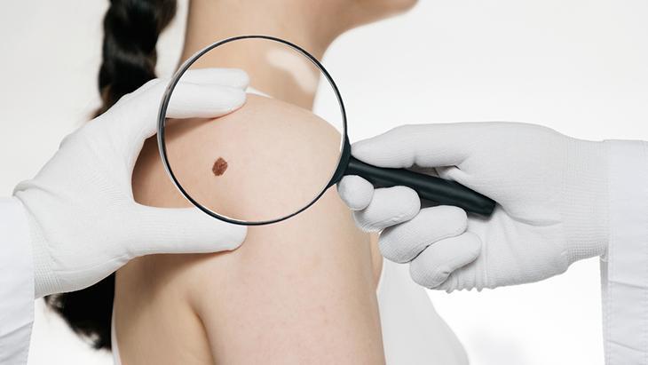 Lazer de yaptıran da var, solüsyon süren de! 'Her ben masum değil, incelenmeli' 4 Lazer de yaptıran da var, solüsyon süren de! 'Her ben masum değil, incelenmeli'