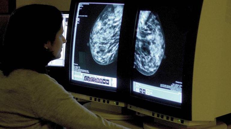 Meme kanserinde yapay zeka devrimi! Hekimler ne diyor: 'Veriyi analiz eder, anlayan biziz'