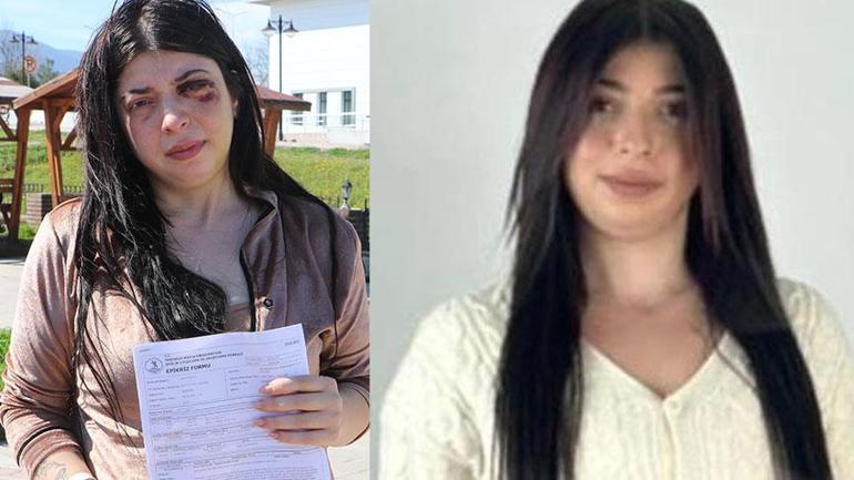 Sokak ortasında darp ve taciz! Damla’ya dehşeti yaşatan cani ile ilgili karar