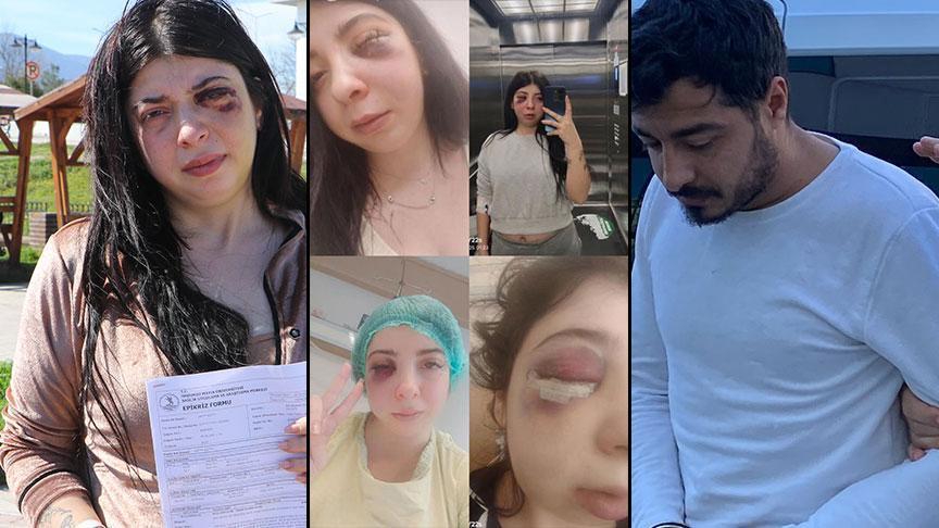 Sokak ortasında darp ve taciz! Damla’ya dehşeti yaşatan cani ile ilgili karar