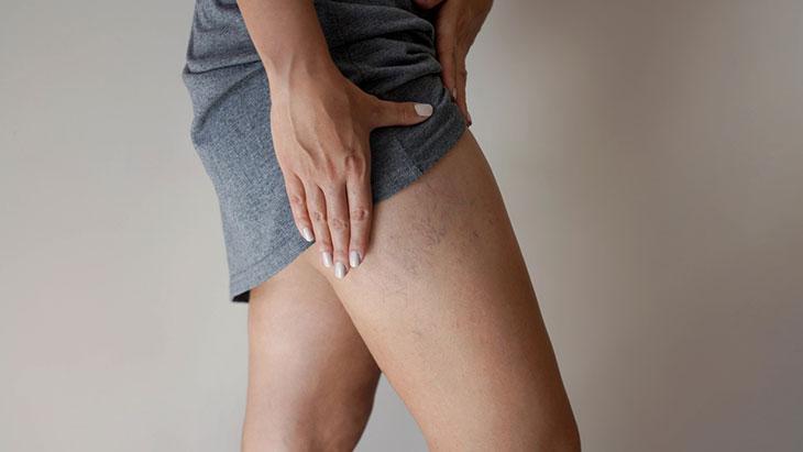 Son yıllarda hızla yaygınlaşıyor! Bu hatalar varise davetiye çıkarıyor