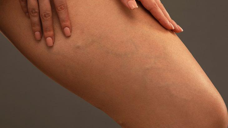 Son yıllarda hızla yaygınlaşıyor! Bu hatalar varise davetiye çıkarıyor