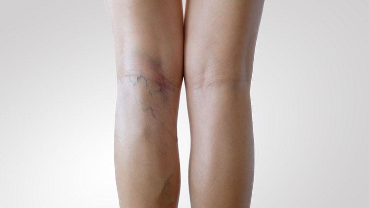 Son yıllarda hızla yaygınlaşıyor! Bu hatalar varise davetiye çıkarıyor