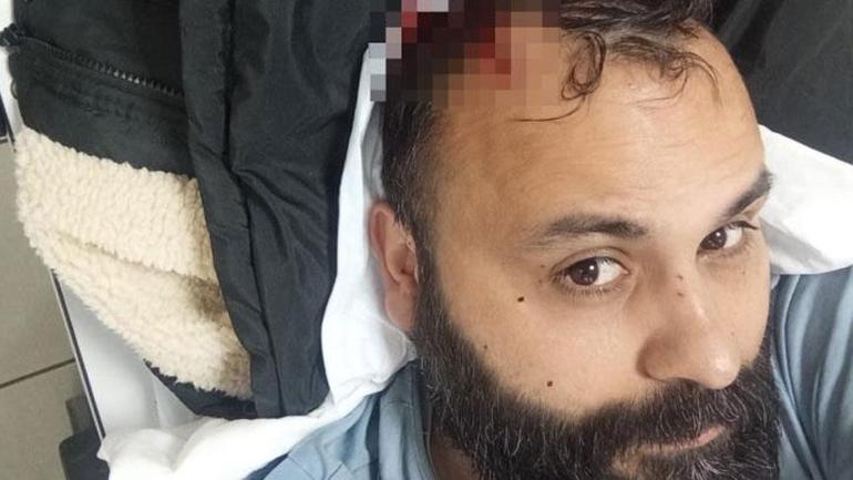 Sosyal medya fenomenine boşanma aşamasındaki eşi ve ailesi dehşeti yaşattı 1 Sosyal medya fenomenine boşanma aşamasındaki eşi ve ailesi dehşeti yaşattı