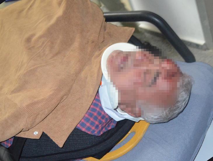 Ters yöne girip dehşet saçan alkollü sürücüyü çevredekiler darbetti