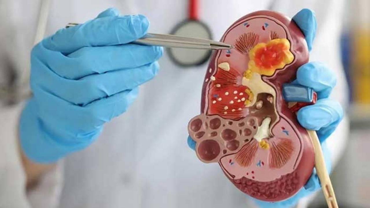 Uzmandan ihtar: Çocuklarda böbrek taşı riski artıyor