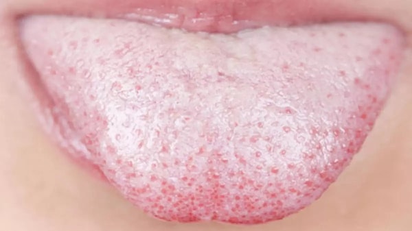 Vücudunuzun Gizli Düşmanı: Kalp ve Böbrekleri Tehdit Eden 5 Sessiz İltihap Belirtisi!