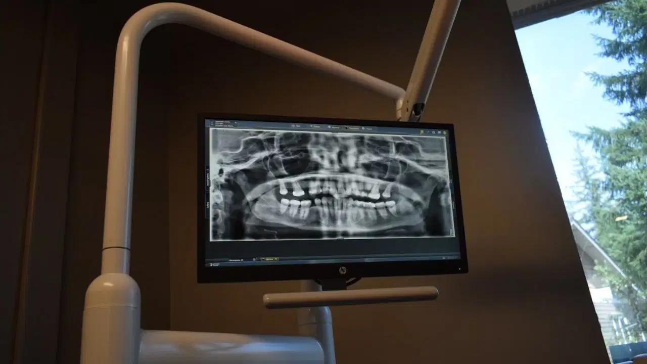 X ışınlarının 130 yıllık seyahati