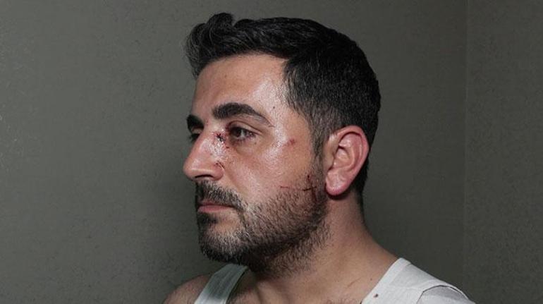 Yer: Esenyurt! Eski kiracı ev sahibini bıçakla yaraladı