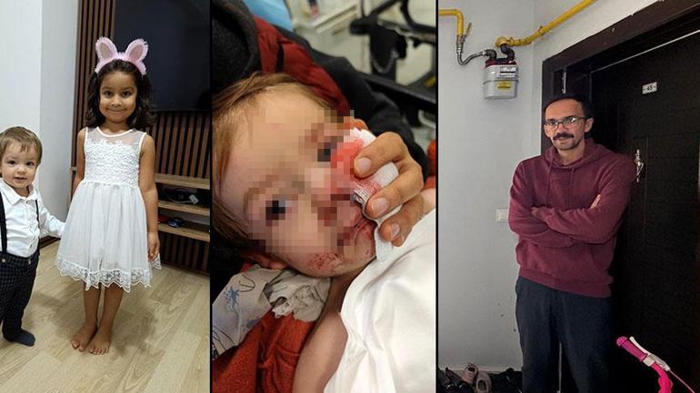 Ankara 1,5 ve 5 yaşındaki çocuklara pitbull saldırdı! Şok detaylar: 'Tasmasını açıp, ısırtmakla tehdit etmiş'