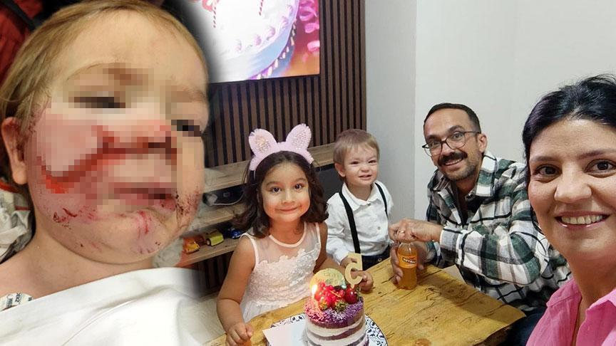 Ankara 1,5 ve 5 yaşındaki çocuklara pitbull saldırdı! Şok detaylar: ‘Tasmasını açıp, ısırtmakla tehdit etmiş’